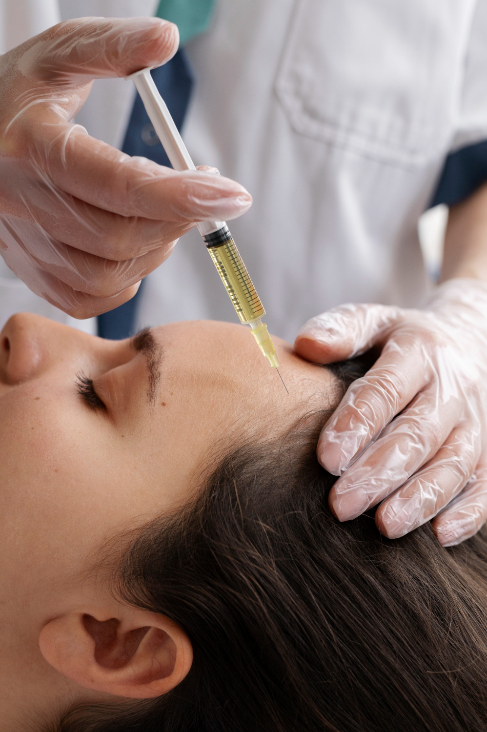 PRP Treatments