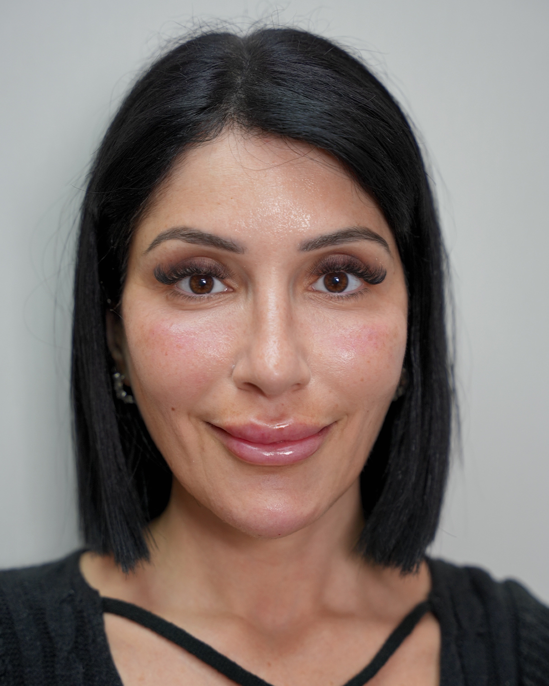After treatment