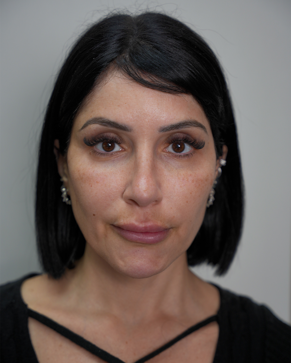 Before treatment