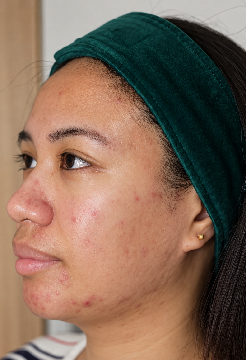 Before treatment
