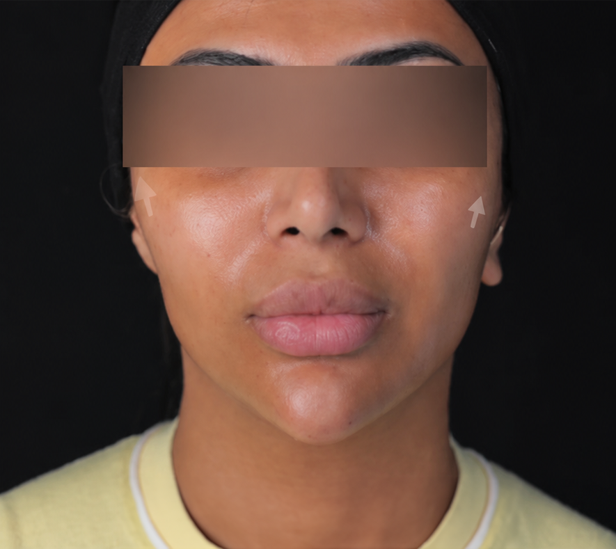 After treatment